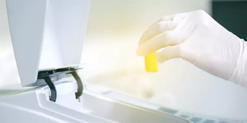 uso farmacéutico y medioambiental de la cubeta de cuarzo