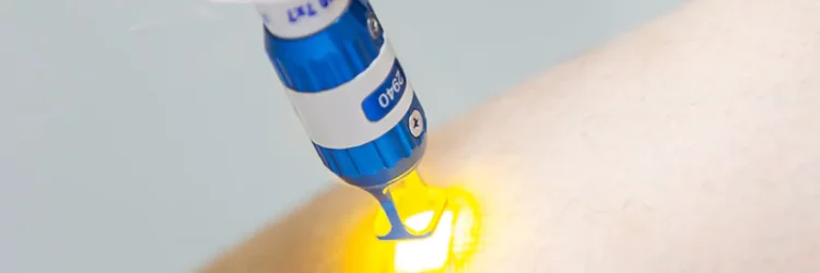TOQUARTZ optical quartz glass components are critical for laser systems TOQUARTZ optical quartz glass components are critical for laser systems